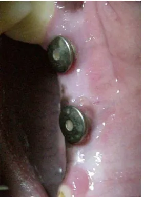 Fig 3 Fig 3
