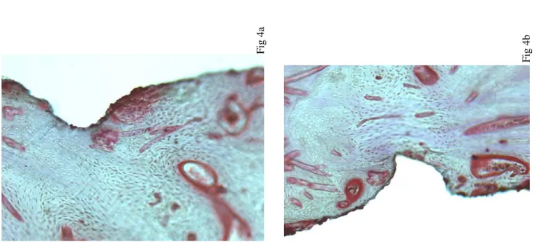 Fig 4a   Fig 4b