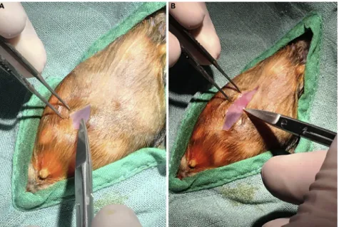 Figure 5. Skin Incision Is Performed by Gently Raising the Skin and Cutting with the Iris Scissors The white line joining the two abdominal muscles (A) and the umbilical scar (B) are visible under the scissors tip