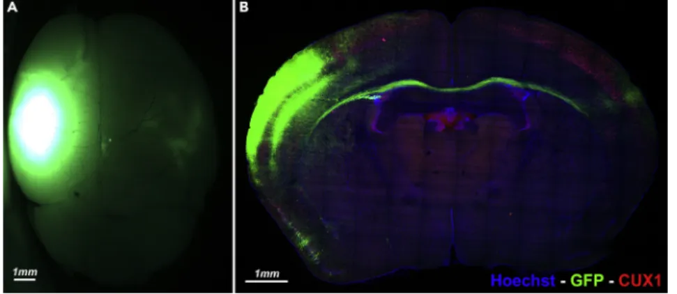 Figure 9. Typical Outcome of In Utero Plasmid Electroporation at Postnatal Age 21 (P21) (A) Dorsal view of a brain electroporated with the fluorescent protein mVenus on the left side (ipsilateral)