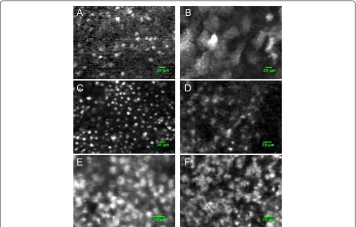 Figure 5 FCFM imaging of the different stages of carcinogenesis of the hamster cheek pouch after staining with acriflavine or methylene blue