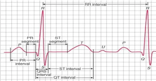 Figure I.11 : Le tracé normal de signal ECG. 