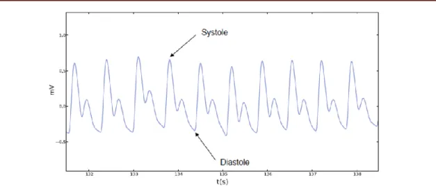 Figure I.19 : La forme du signal PPG. [22] 