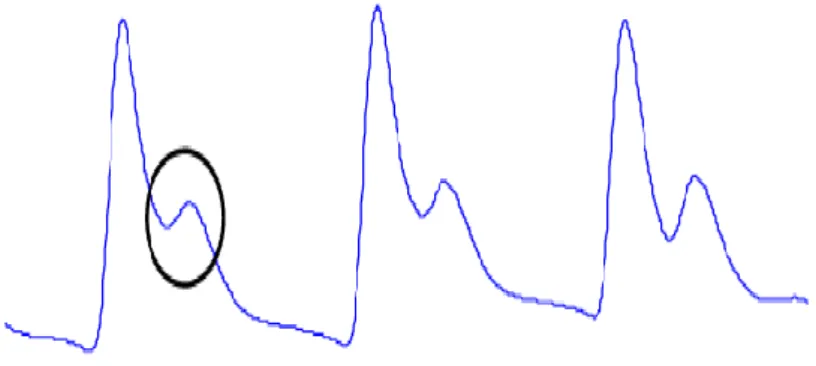 Figure I.20 : Représentation de la composante pulsatile d’un signal PPG où l’onde dicrote est  visuellement identifiable [22] 