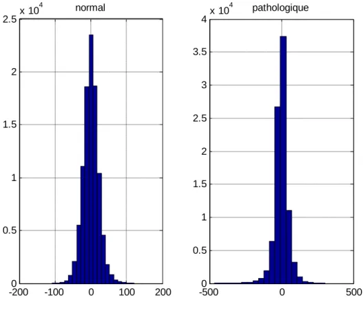 Figure III.3 : Histogramme de canal 17 
