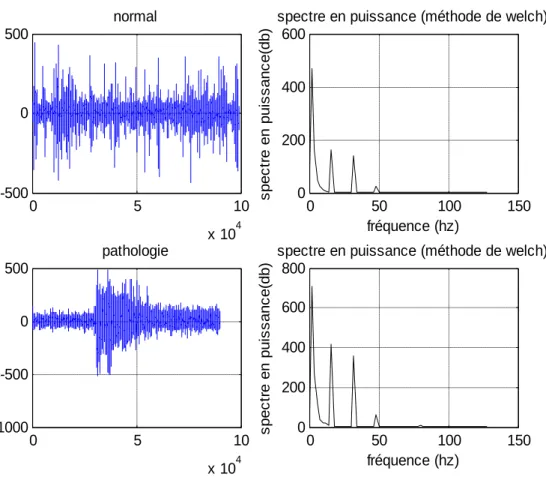 Figure III.6 : L’analyse spectrale du canal 21 