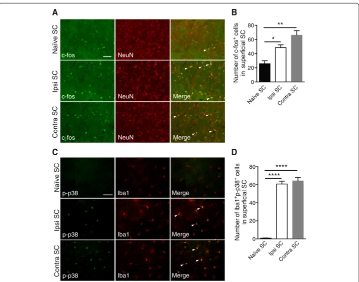Fig. 6 EVC induces inflammation, c-fos, and p-p38 pathway activation in right and contralateral SCs