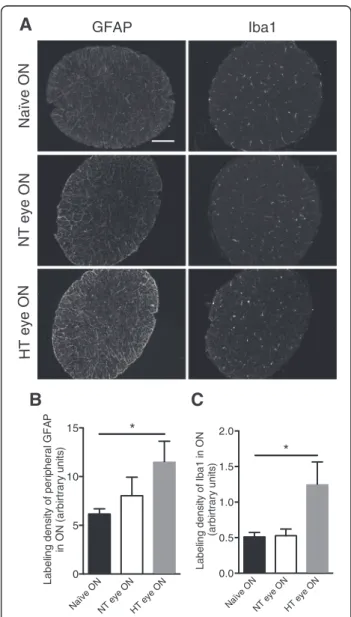 Fig. 2 EVC induces retinal inflammation and microglial activation in both HT and NT eyes