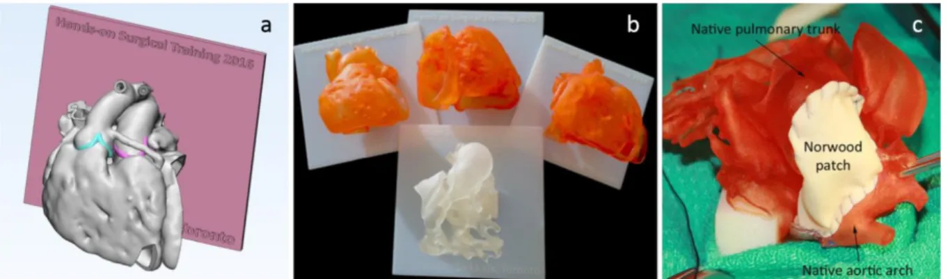 Figure 4. 3D printed cardiac models for surgical practice or training. Reprinted with permission from [117]