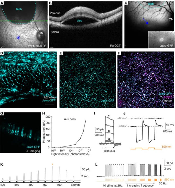 Figure 6. AAV9-7m8 transduces the fovea via delivery in a distal bleb and provides robust optogenetic light responses with PR1.7-Jaws