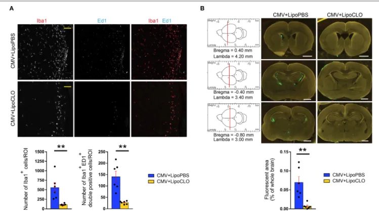 FIGURE 3 | Clodronate liposomes deplete microglia and reduce CMV spreading in the developing brain