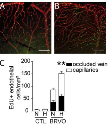 Fig 6. Hypoxia induced endothelial cell proliferation in control and BRVO retinas. (A and B)