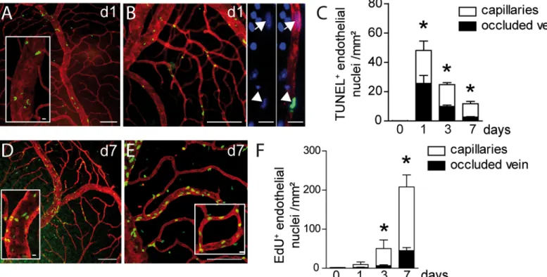 Fig 2. Vascular endothelial cell apoptosis and proliferation after BRVO. (A and B) Representative micrographs of TUNEL (green) — CollIV (red) double labeled retinal flatmounts at 1d after BRVO of the occluded vein (A) and the upstream capillary bed (B)