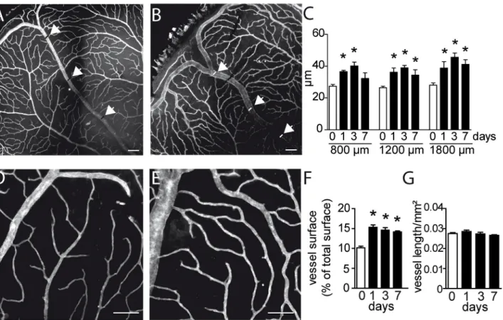 Fig 3. Morphometric analysis of vascular network remodeling after BRVO. (A and B) Representative micrographs of CollIV-labeled retinal flatmounts of a control retina (A) and of the occluded vein after BRVO at 3d (B)