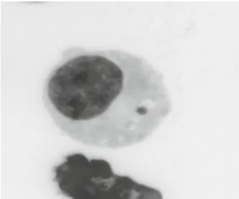 Figure  5:  Photograph  of  a  micronucleus  in  a  mononucleate  L5178Y  cell  (the  image  was  captured from an acridine orange preparation in fl uorescent colours and then negative image  was used to convert it into grey scale) (Doherty, 2012)