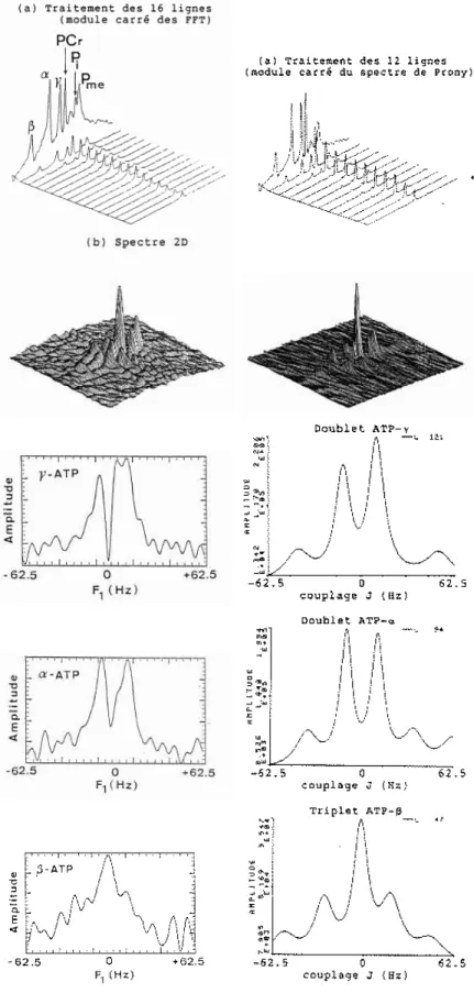 Fig. 2.3 - Resultats sur signaux in vivo: FFT a gauche ; methode parametrique a droite.