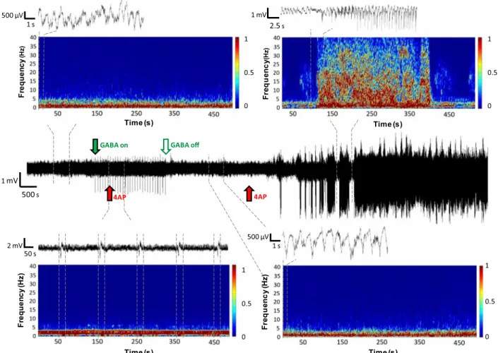 Fig. 4. Representative recording from an anesthetized mouse given a 4AP injection during a period of GABA delivery (solid green arrow until open green arrow)  followed by a second 4AP dose administered several minutes after the FIP treatment was stopped