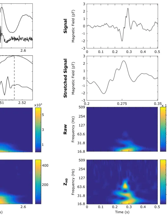 Fig. 8. An example of a simulated Fast-Ripple (FR) occurring during a sharp transient