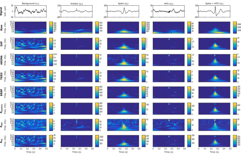 Fig. 2. Examples of the 5 types of simulated events in time and time-frequency domains