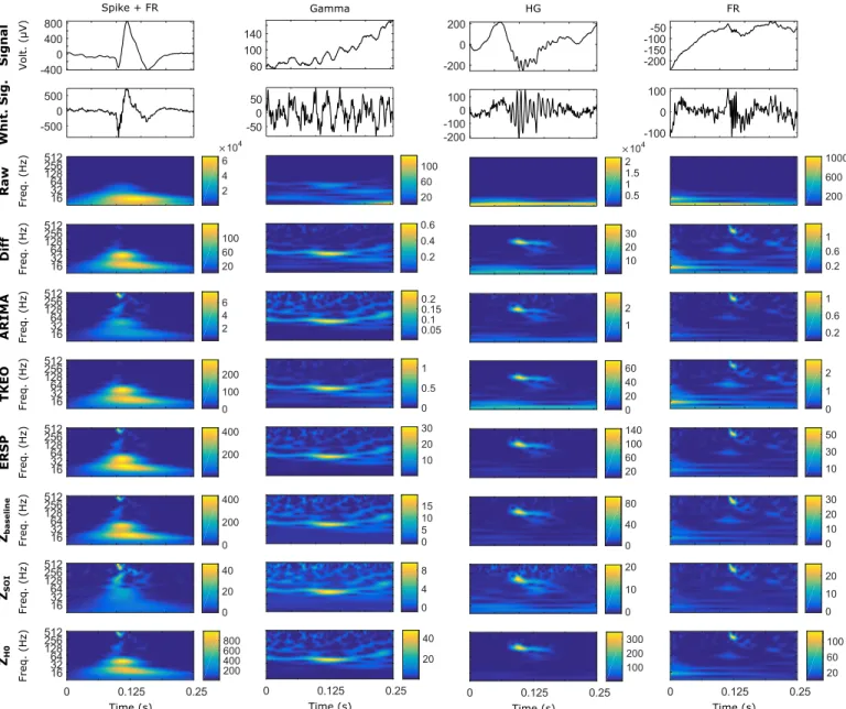 Fig. 6. Examples of 4 real events in time and time-frequency domains. The events are represented in a 250 ms-windows and are taken from 2 patients