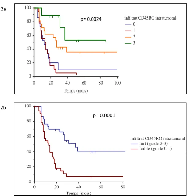 Figure  2a  et  2b :  survie  sans  récidive  selon  la  densité  intratumorale  en  lymphocytes  T  mémoires CD45RO+