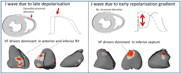 Figure 6: Typical location of VF driver regions. The locations of reentries are shown in red