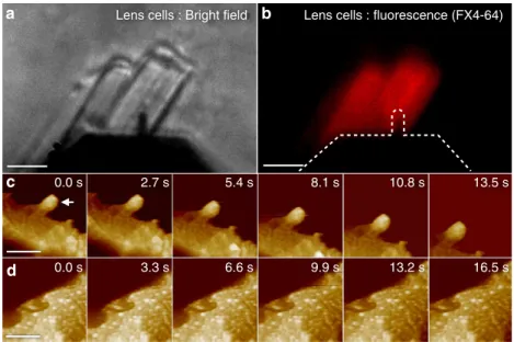 Figure 4 | Overview HS-AFM–OM analysis of native lens cells. (a) Bright ﬁeld and (b) ﬂuorescence (FX4-64 membrane staining) OM images of short HS-AFM cantilever placed on lens cells in the HS-AFM setup (scale bars: 10 mm)