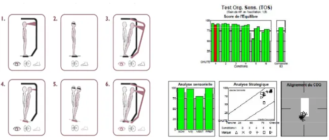 Figure  6  –  Test  d’organisation  sensorielle  (EquiTest).  A  gauche :  les  six  conditions