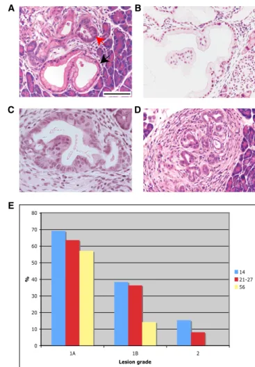 Figure 1. Kras G12D Activation in Distinct Cell Populations of the Adult Pancreas