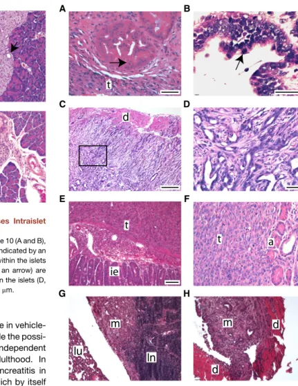 Figure 3. Kras G12D Activation by Pdx1CreER TM Causes Intraislet Ductal/Acinar Lesions