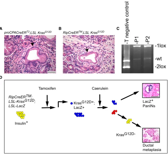 Figure 5. Chronic Pancreatitis Promotes mPanIN Formation in Mouse Models Largely Refractory to Kras G12D Activation Alone