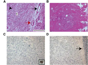 Figure 7. Kras G12D Activation and p53 Loss Followed by Chronic Pancreatitis Results in mPanIN2 3 and PDAC Development from Insulin + Cells