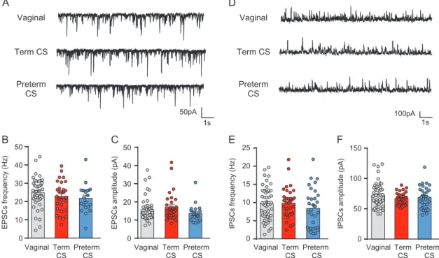 Figure 5. CS delivery at term or preterm does not affect spontaneous glutamatergic and GABAergic network activities in CA3 pyramidal neurons at P14–P15