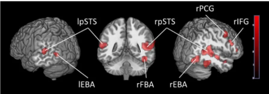 Fig. 1. Brain activity when contrasting Dynamic Bodies > Dynamic Objects in Adults