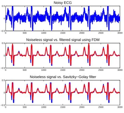 Figure 2: Top: a noisy electrocardiogram u; Middle: in red the noiseless signal, in blue the filtered signal with finite difference scheme (14) with a = 4, b = 0.5, λ = 1.7, δx = 1 and δt = 0.1; Bottom : Noiseless signal (blue) vs