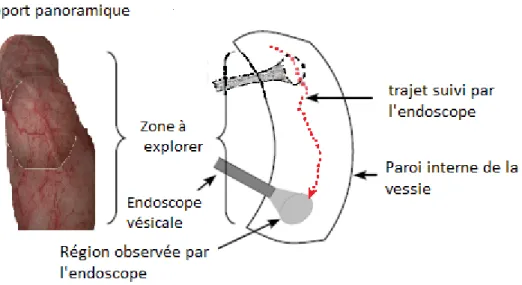 Figure 1.12 : Schéma illustrant le  trajet de l'endoscope pour la  construction d‟images  panoramiques de l‟intérieur de la vessie 16 