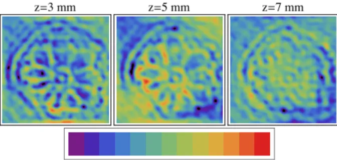 FIG. 8. RTE reconstructions of a lotus-root slice. The field of view is 9 cm × 9 cm. The number above each panel shows the distance from the source plane.