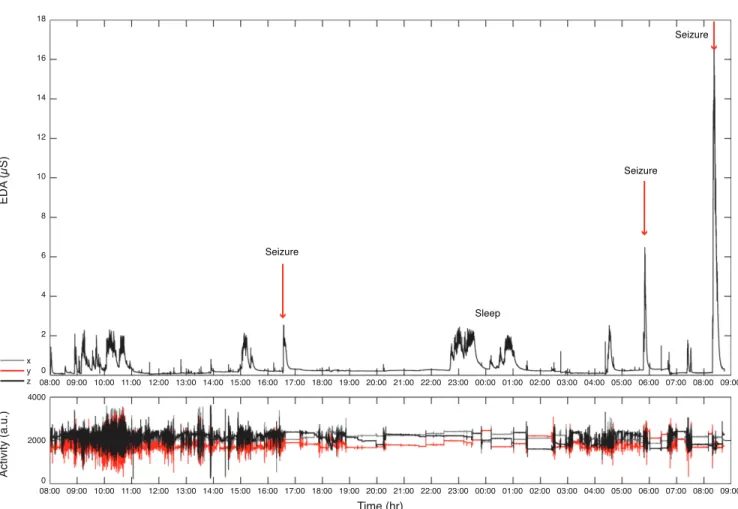 Figure  4  shows  a  close-up  of  EDA  changes  during  two  different  seizures  types  (red  lines  mark  the  ictal  onset  and  offset  times)