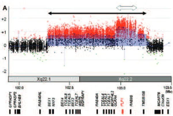 Figure 6 (from (Shimojima et al., 2012)): Array-CGH analysis with abnormal patient/control  signal ratio illustrating a duplication encompassing several genes of the X-chromosome (black  arrow),  and  a  triplication  of  PLP1 (white  arrow) in  a  female 