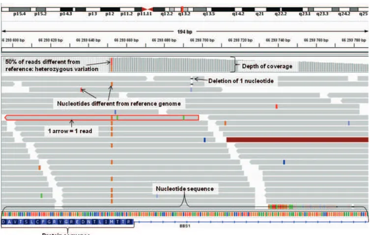 Figure  7: Visualization  of  high  throughput  sequencing data zoomed  on BBS1 for  one  BBS  patient, using integrative genome viewer (IGV; http://www.broadinstitute.org/igv/).