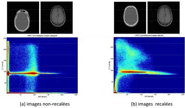 Figure  1.4  -  Histogramme  conjoint  d’un  couple  scanner/IRM  (coupes  axiales) calculé pour deux transformations différentes.Repris de Roche [39]