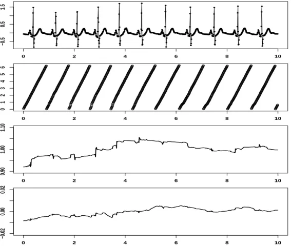 Figure 5: Estimation results for the ECG recordings. The plots show (from top to bottom): the ECG data points;