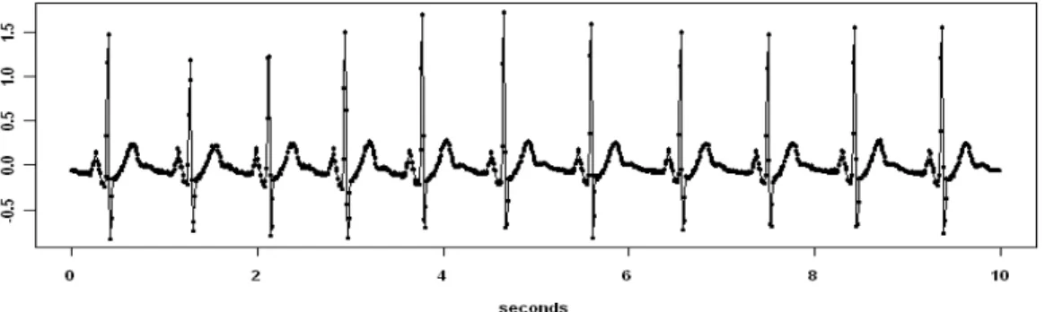 Figure 1: 1000 Observations from an ECG