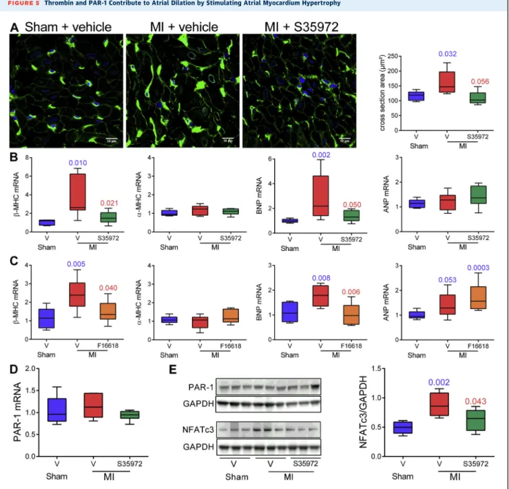 FIGURE 5 Thrombin and PAR-1 Contribute to Atrial Dilation by Stimulating Atrial Myocardium Hypertrophy