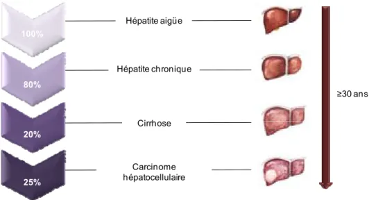 Figure 2. Histoire naturelle de l’infection par le HCV.  Après l’infection initiale, environ 80% des  personnes vont développer une hépatite chronique