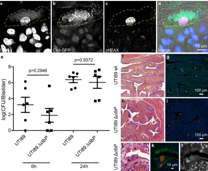 Fig 4. Colibactin is produced during UTI and induces DNA damage. a-d. Confocal microscopic detection of ClbI-GFP expression and pH2AX in frozen bladder sections, 6 hours post infection with UTI89, hosting the p-clbI-gfp fusion plasmid