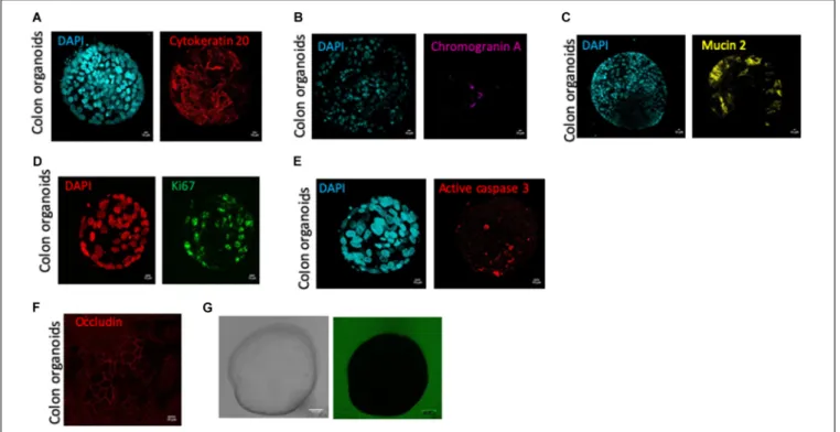 FIGURE 2 | Human colon organoid cell type composition and organoid sealing observation