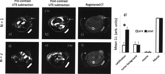 Figure 3.4  - In-vivo  MRI  of contrast  uptake  to tumor calcifications