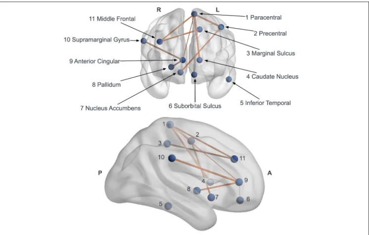 FIGURE 5 | Network based statistics (NBS) impaired subnetwork. Coronal and sagittal views of impaired subnetwork nodes and interconnections identified by NBS (11 nodes and 10 edges)