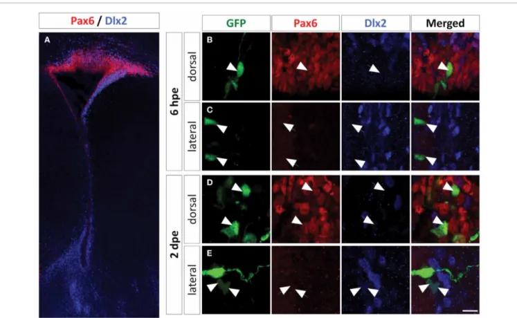 FIGURE 3 | Dlx2 expression in the PVZ is restricted to the non-radial glial progenitor cells of the lateral wall